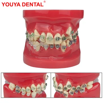 Стоматологическая ортодонтическая модель Лечение скученных зубов Стандартная обучающая модель Модель зубов с наполовину металлическими, наполовину керамическими брекетами